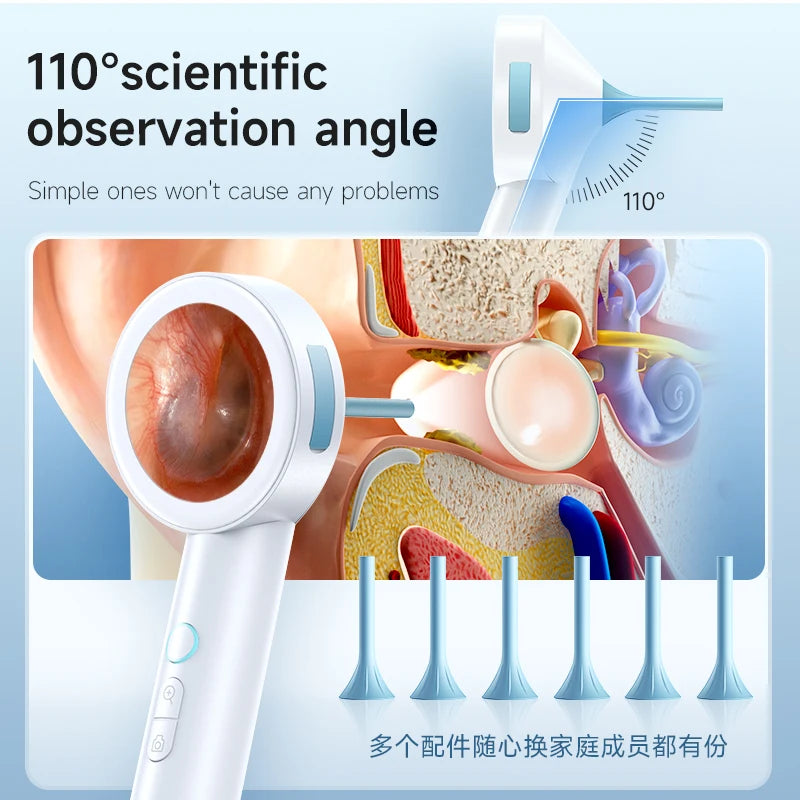 HD Visual Ear Cleaner 1.8’’ Screen Ear Camera  Instant On/Record, Home & Pet Otoscope for Kids/Adults/Dogs/Cats,