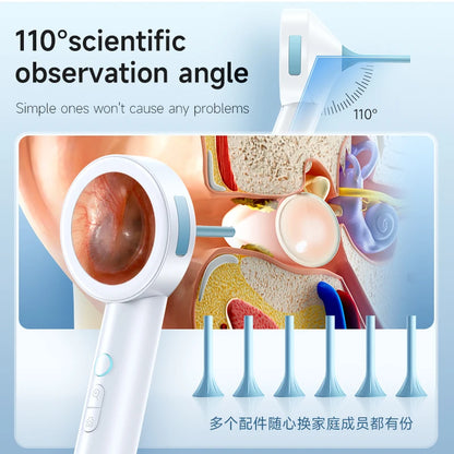 HD Visual Ear Cleaner 1.8’’ Screen Ear Camera  Instant On/Record, Home & Pet Otoscope for Kids/Adults/Dogs/Cats,